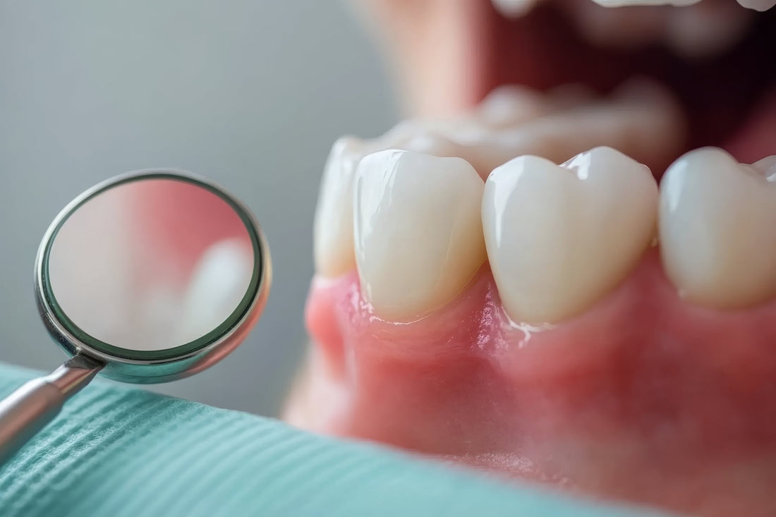 White Spots on Teeth: What Remineralization Can Fix
