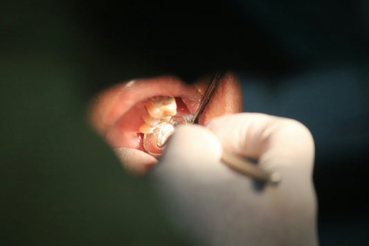 Signs of Weak Enamel: What Your Sensitive Teeth May Be Telling You